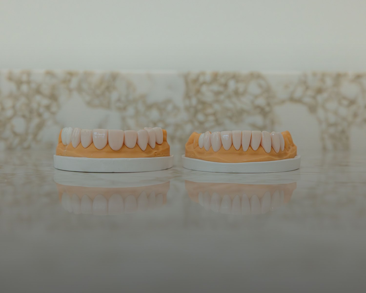 Dental wax-up models used to design a smile makeover at Doctor Laleh Dental Aesthetics